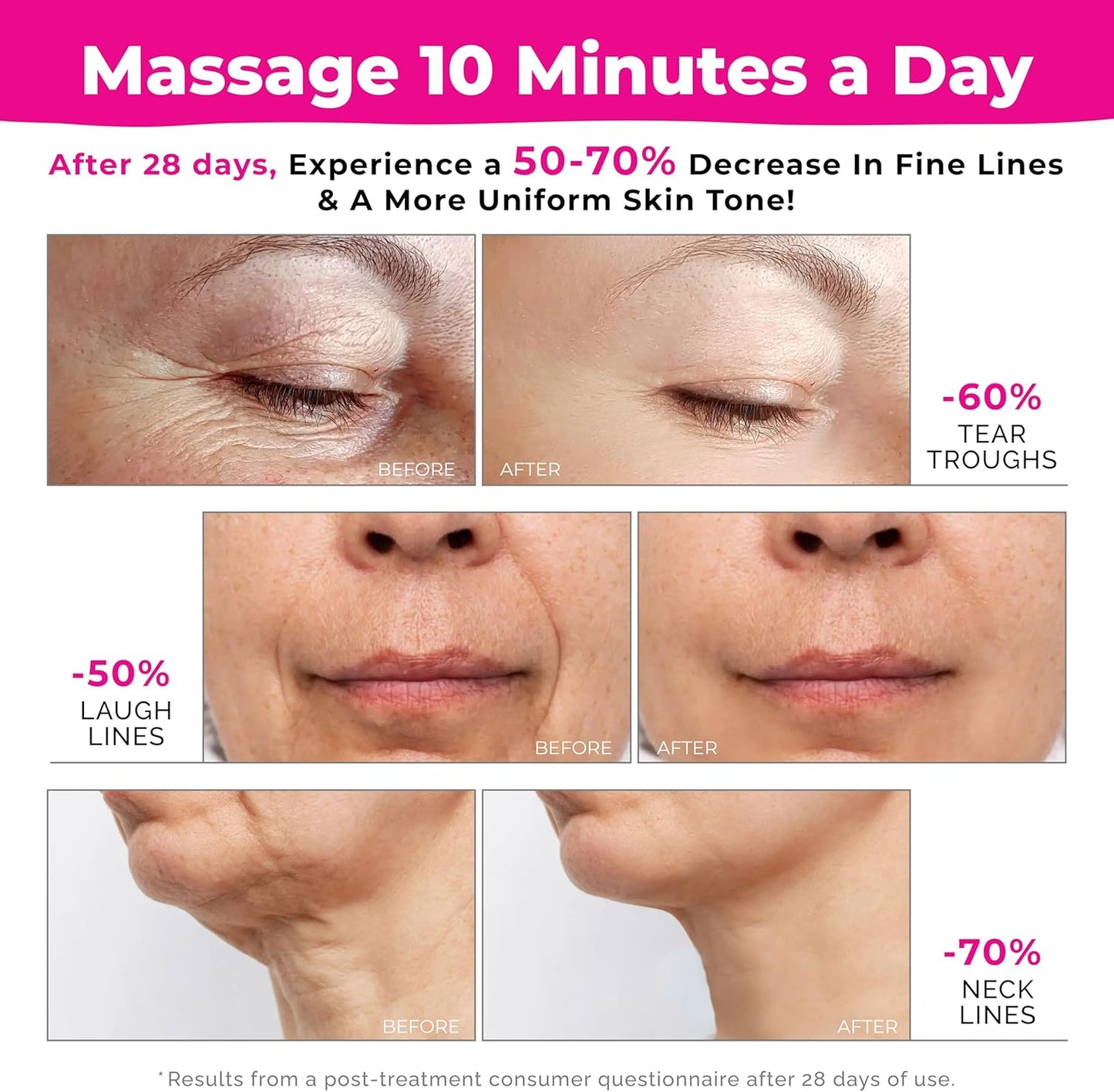 Biidey PinkNext Glow Facial Massager